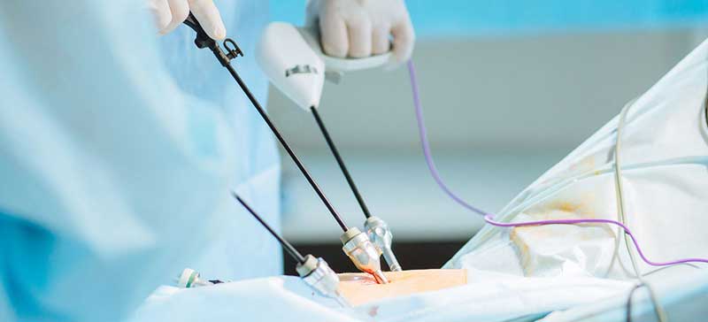 Fertility Enhancing Surgeries