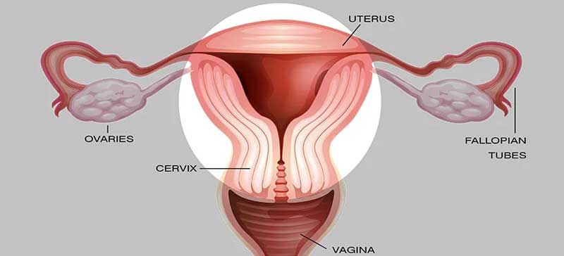 Vaginal Hysterectomy
