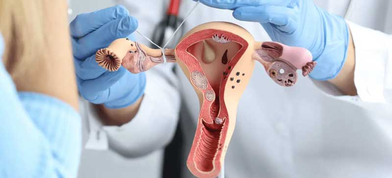Family Planning Surgery