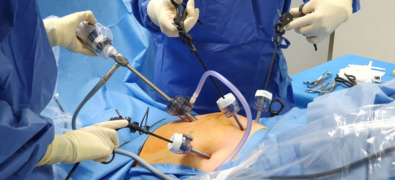 Laparoscopic Surgeon in Borivali West - Dr. Nimish Tutwala